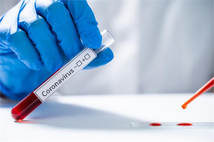Im Auftrag des Südtiroler Sanitätsbetriebes wurden bisher insgesamt 83.729 Abstriche von 40.655 Personen auf das neuartige Coronavirus untersucht. (Symbolbild: freepik)