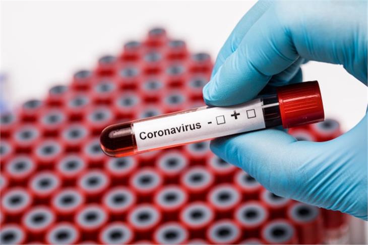 Im Auftrag des Südtiroler Sanitätsbetriebes wurden bisher 96.840 Abstriche von 49.079 Personen auf das neuartige Coronavirus untersucht. (Symbolbild: it.freepik.com)