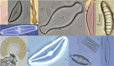 Sono 641 le differenti specie di diatomee individuati nei corpi idrici in Alto Adige, qui ripresi al microscopio (Foto: Agenzia ambiente e tutela clima)
