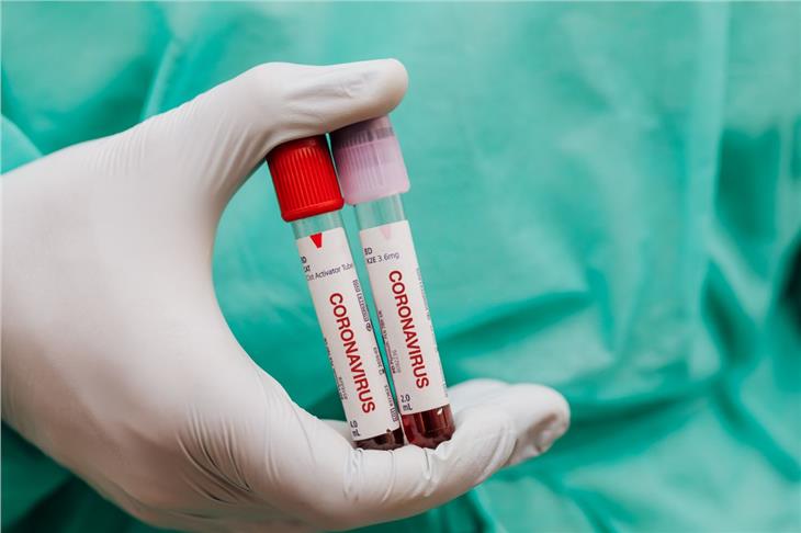 Sono 41 i nuovi casi di persone positive al Coronavirus in Alto Adige (Foto: kaboompics.com)