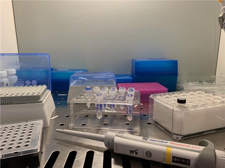 677 tamponi sono stati esaminati ieri, 74 erano positivi. (Foto: ASDAA)