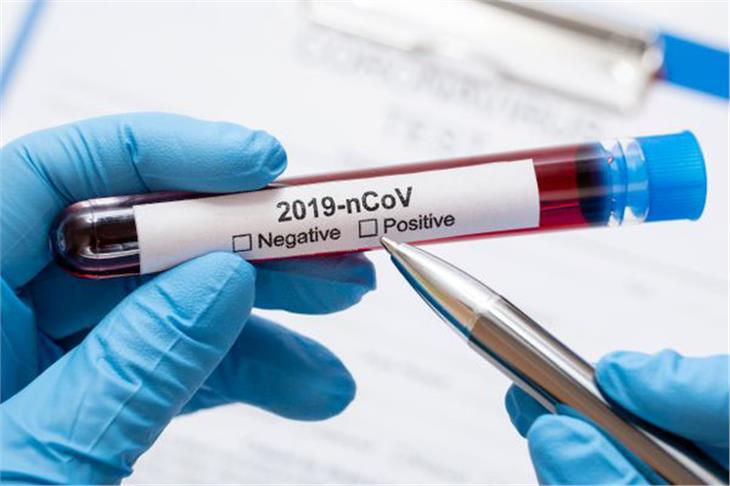 Finora sono risultate positive al test del Coronavirus in totale 1.082 persone (Foto: pexels.com)