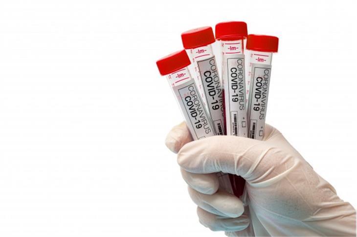 Continuano i test per il Coronavirus (Immagine: it.freepik.com)