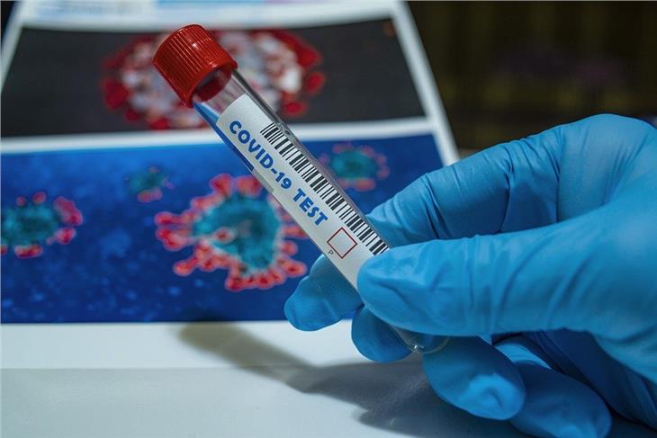 Coronavirus: I laboratori dell'Azienda sanitaria altoatesina nelle ultime 24 ore hanno effettuato 599 tamponi. Due sono risultati positivi. (Immagine simbolica: pixabay)